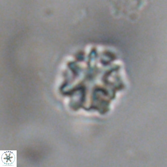 Discoaster puvillandii VR 18152