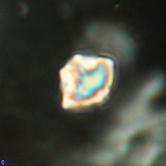 Discoaster puvillandii VR 18167