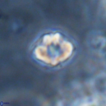 Discoaster puvillandii VR 18160