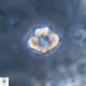Discoaster puvillandii VR 18160