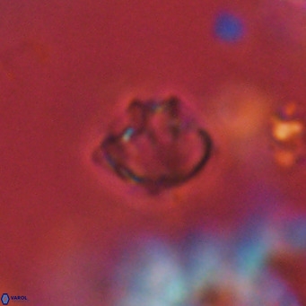 Discoaster puvillandii VR 18163