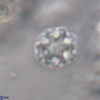 Discoaster puvillandii VR 18174