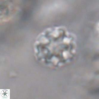 Discoaster puvillandii VR 18174