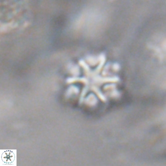Discoaster puvillandii VR 18175
