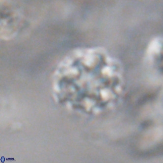 Discoaster puvillandii VR 18176