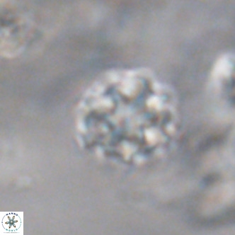 Discoaster puvillandii VR 18176