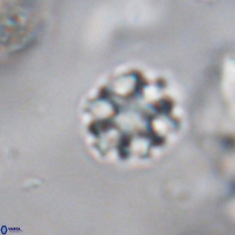 Discoaster puvillandii VR 18177