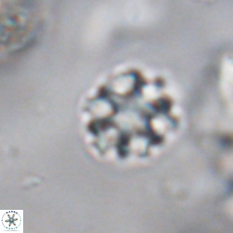 Discoaster puvillandii VR 18177