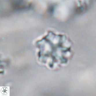 Discoaster puvillandii VR 18179