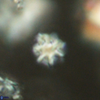 Discoaster puvillandii VR 18170