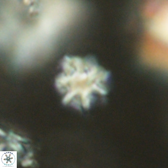 Discoaster puvillandii VR 18170