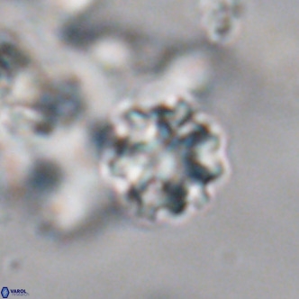 Discoaster puvillandii VR 18173