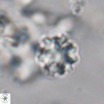 Discoaster puvillandii VR 18173