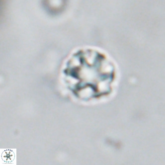 Discoaster puvillandii VR 18184
