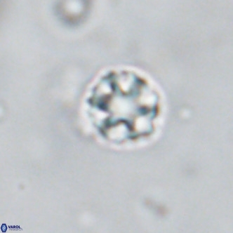 Discoaster puvillandii VR 18185