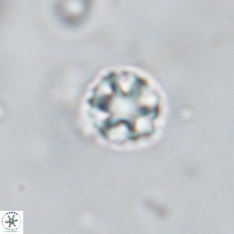 Discoaster puvillandii VR 18185
