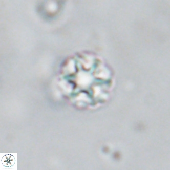 Discoaster puvillandii VR 18186