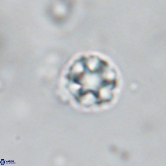 Discoaster puvillandii VR 18187