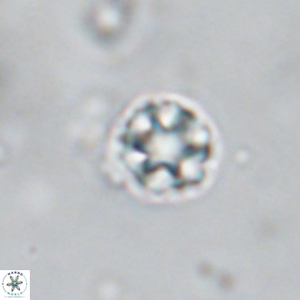 Discoaster puvillandii VR 18187