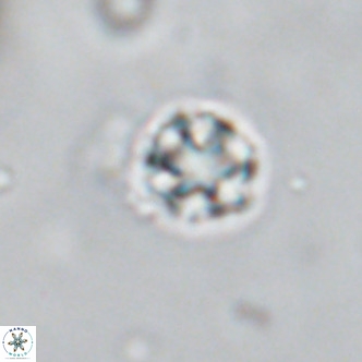 Discoaster puvillandii VR 18188