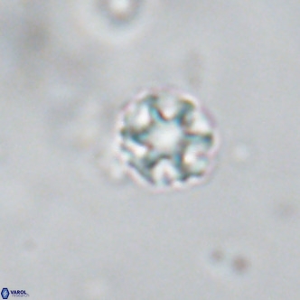 Discoaster puvillandii VR 18189