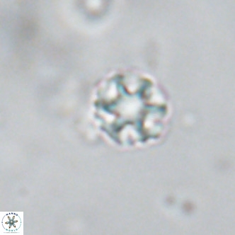 Discoaster puvillandii VR 18189