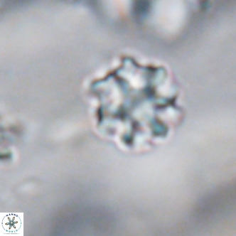 Discoaster puvillandii VR 18180