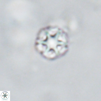 Discoaster puvillandii VR 18194