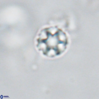 Discoaster puvillandii VR 18195