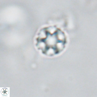 Discoaster puvillandii VR 18195