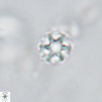 Discoaster puvillandii VR 18196