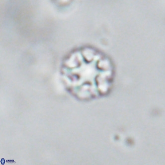 Discoaster puvillandii VR 18190