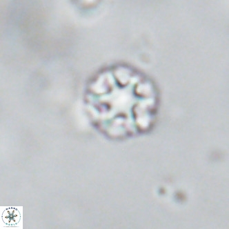 Discoaster puvillandii VR 18190