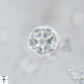 Discoaster puvillandii VR 18191