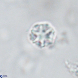 Discoaster puvillandii VR 18193