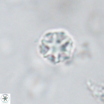Discoaster puvillandii VR 18193