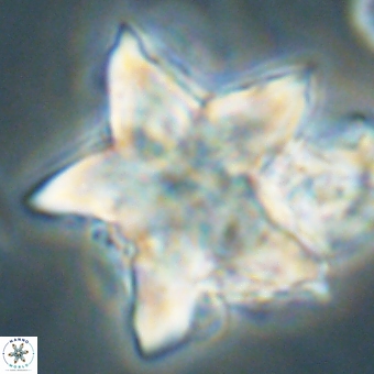 Discoaster paelikei 68871