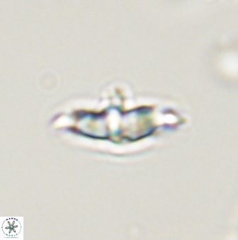 Discoaster pentabollii 47316