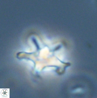 Discoaster pentabollii 47311