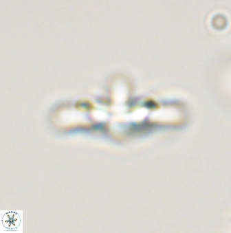 Discoaster pentabollii 47313