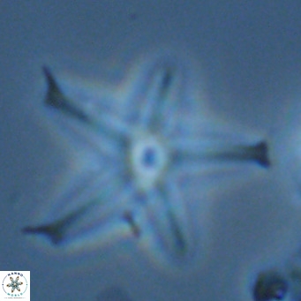 Discoaster pentaradiatus VR 07548