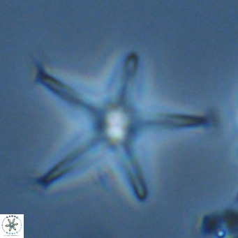 Discoaster pentaradiatus VR 07551