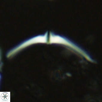 Discoaster pentaradiatus VR 07380