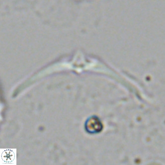 Discoaster pentaradiatus VR 07391