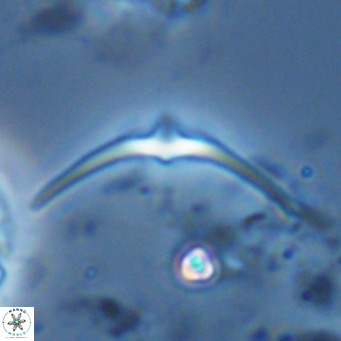 Discoaster pentaradiatus VR 07392