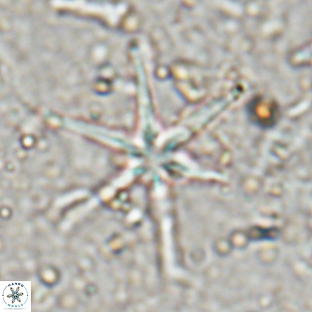 Discoaster petaliformis 27173