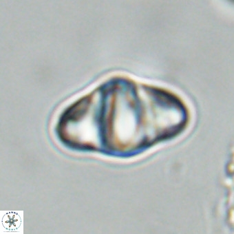 Discoaster premicros VR 19147