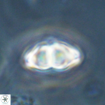 Discoaster premicros VR 19133