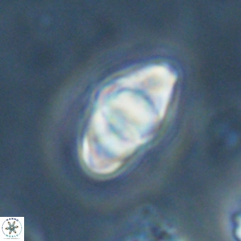 Discoaster premicros VR 19135