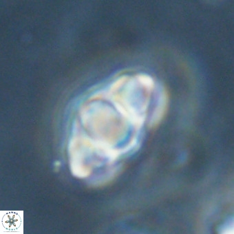 Discoaster premicros VR 19136